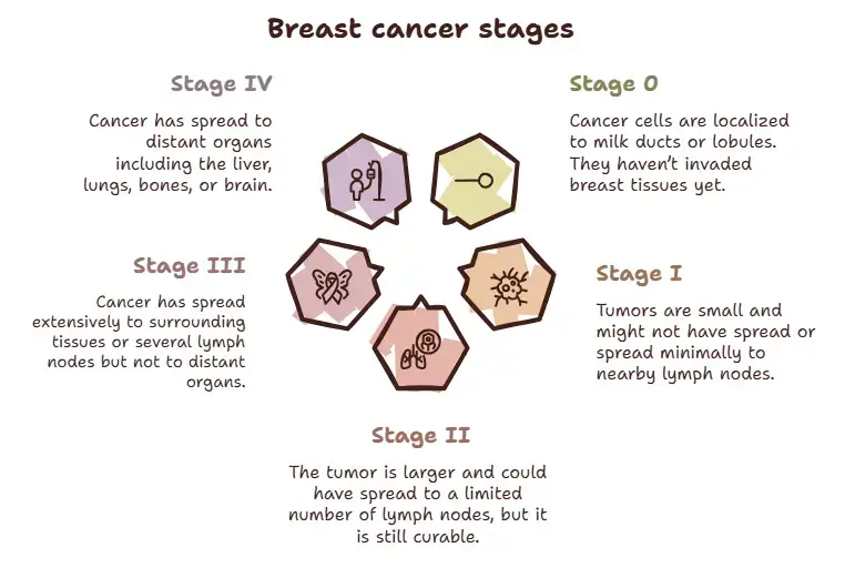 Stages of breast cancer - Specialitymedz